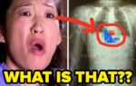 21 Surgeons Share Unexpected Moments From Surgery