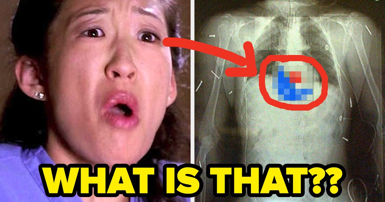 21 Surgeons Share Unexpected Moments From Surgery