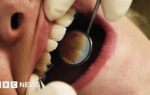 Patients of retired dentist asked to test for bloodborne virus