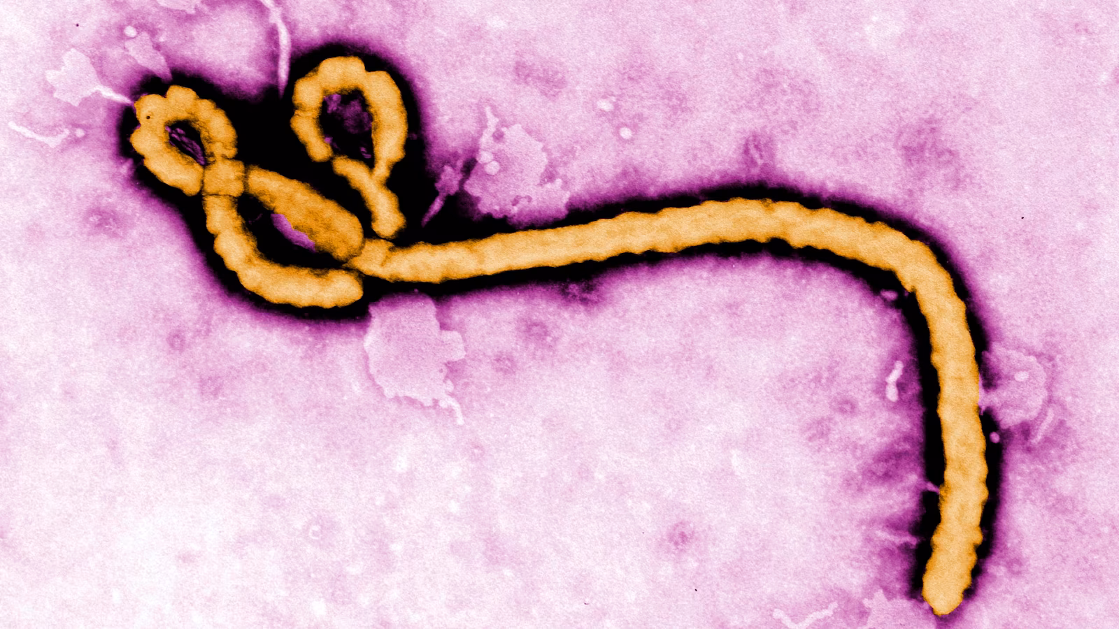 A look at major Ebola outbreaks and when the disease was first identified